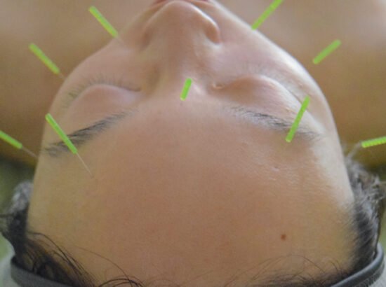 Wellness on Whyte - Facial