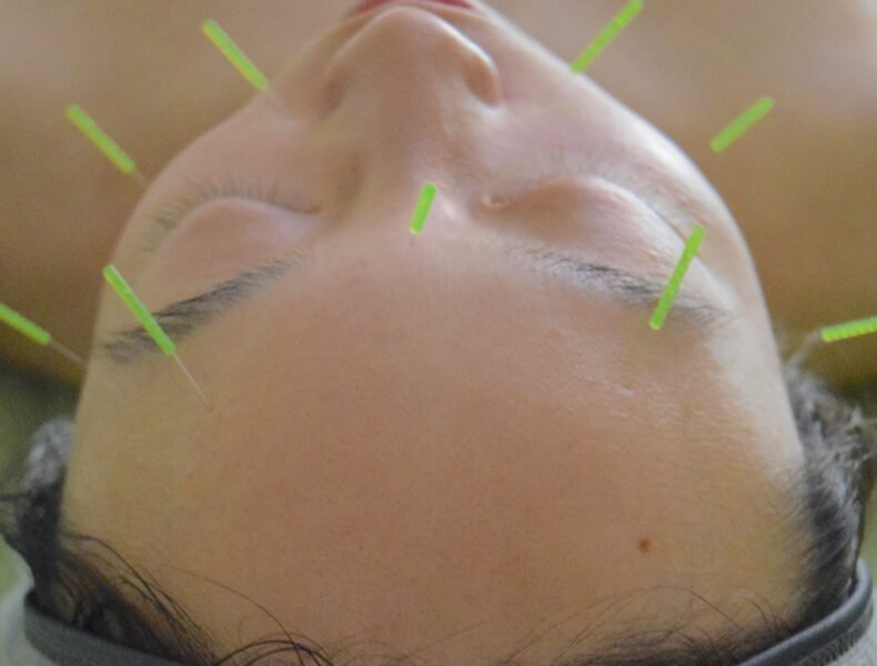 Wellness on Whyte - Facial